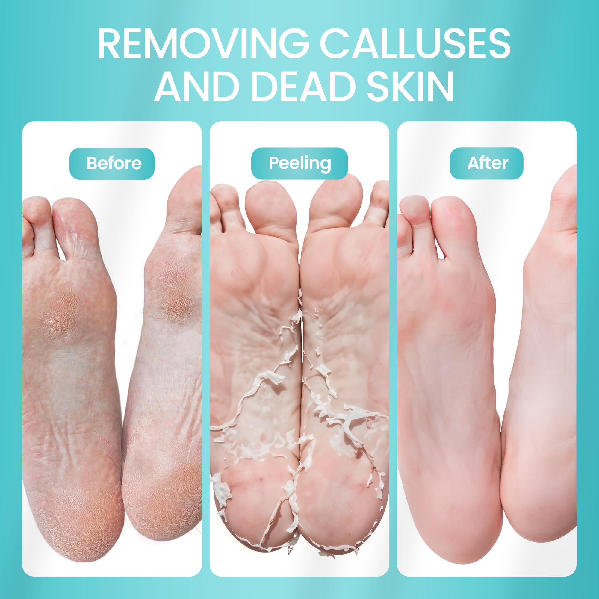 Foot Peeling Mask for Dead Skin Remover & Deep Moisturize | 2 Pairs | Dermatologically Tested - Foot Peel Mask for Dry Cracked Feet - Foot Mask make Soft Baby Feet for Men & Women | Aloe Vera