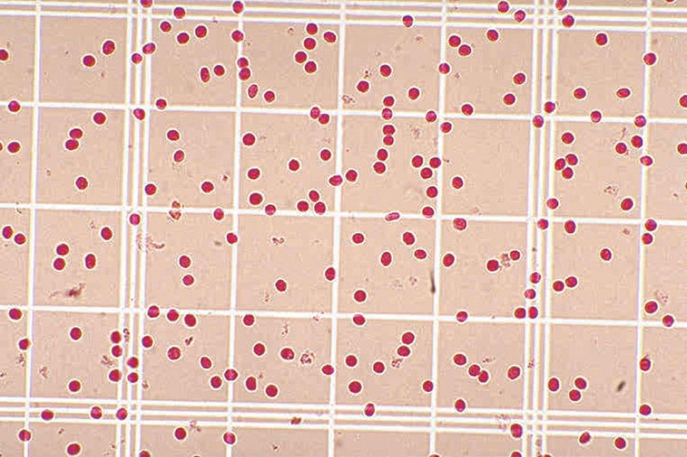 470023666EA Description Simulated Red Blood Cell Counts with a