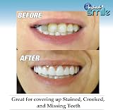 Instant Smile Comfort Fit Flex Cosmetic Upper Teeth Bright White Veneer view 4