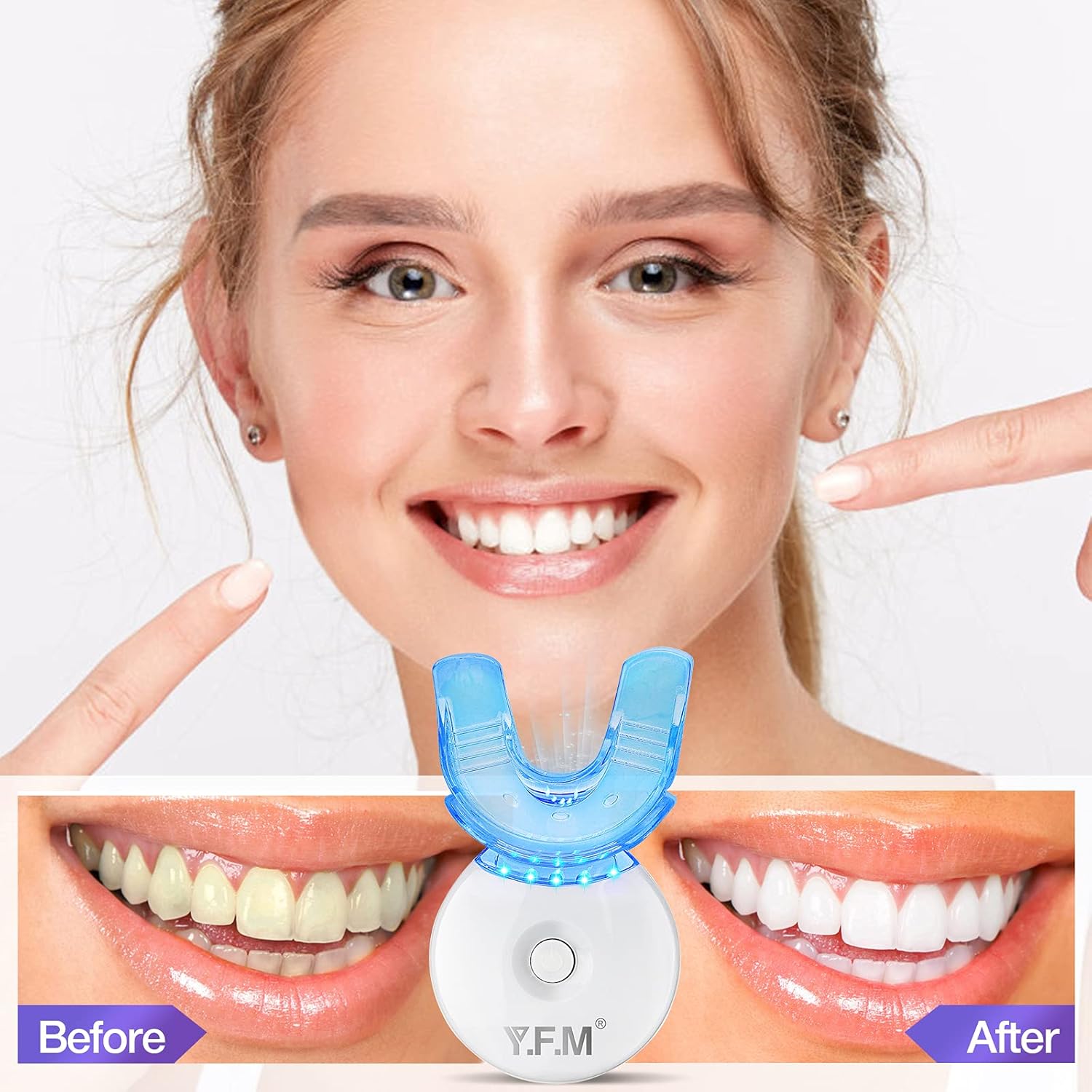 Teeth Whitening Kit, Y.F.M Professional Home Whitening Teeth Kit, 11pcs Teeth Whitening Gel, 2pcs Soothing Gel, 5X LED Light Tooth Whitener, 10 Min Non-Sensitive Fast Teeth Whitener: Health & Personal Care