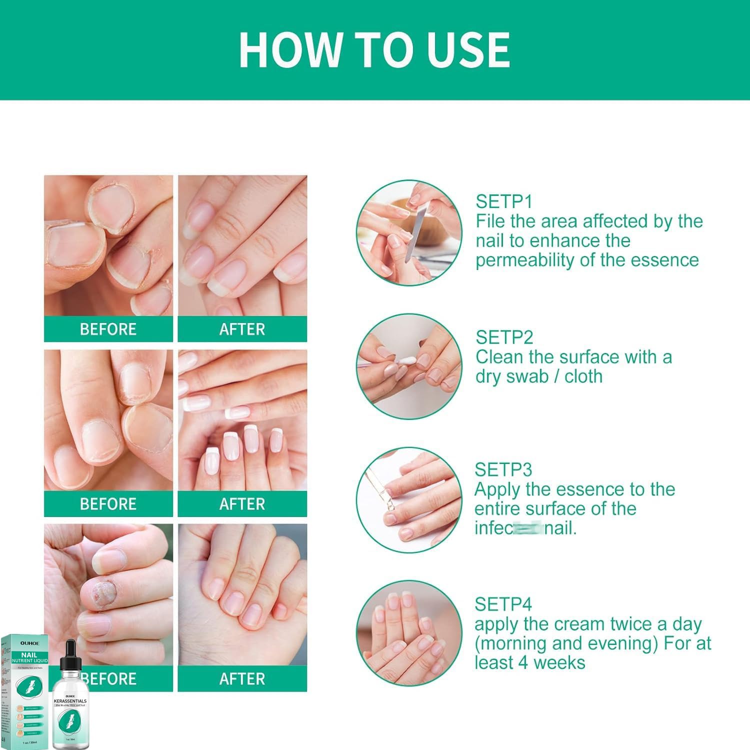 Kerassentials Toenail Oil, Kerassentials Nails colourless (3PCS) - Image 6