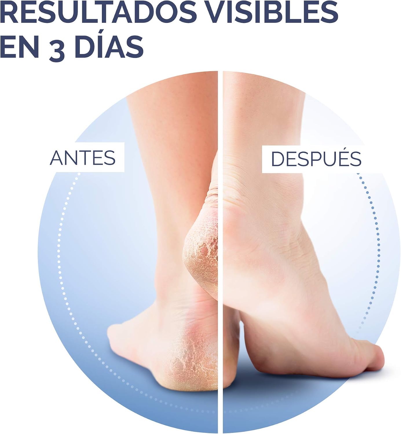 SCH Foot Creams, 60 ml, 60 ml (Pack of 1) - Image 5