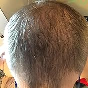 Customer image