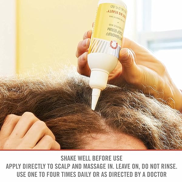 FIRST AID BEAUTY FAB ANTI-DANDRUFF SCALP TREATMENT – FIGHTS DANDRUFF, INSTANTLY SOOTHES DRY SCALP – 3 OZ