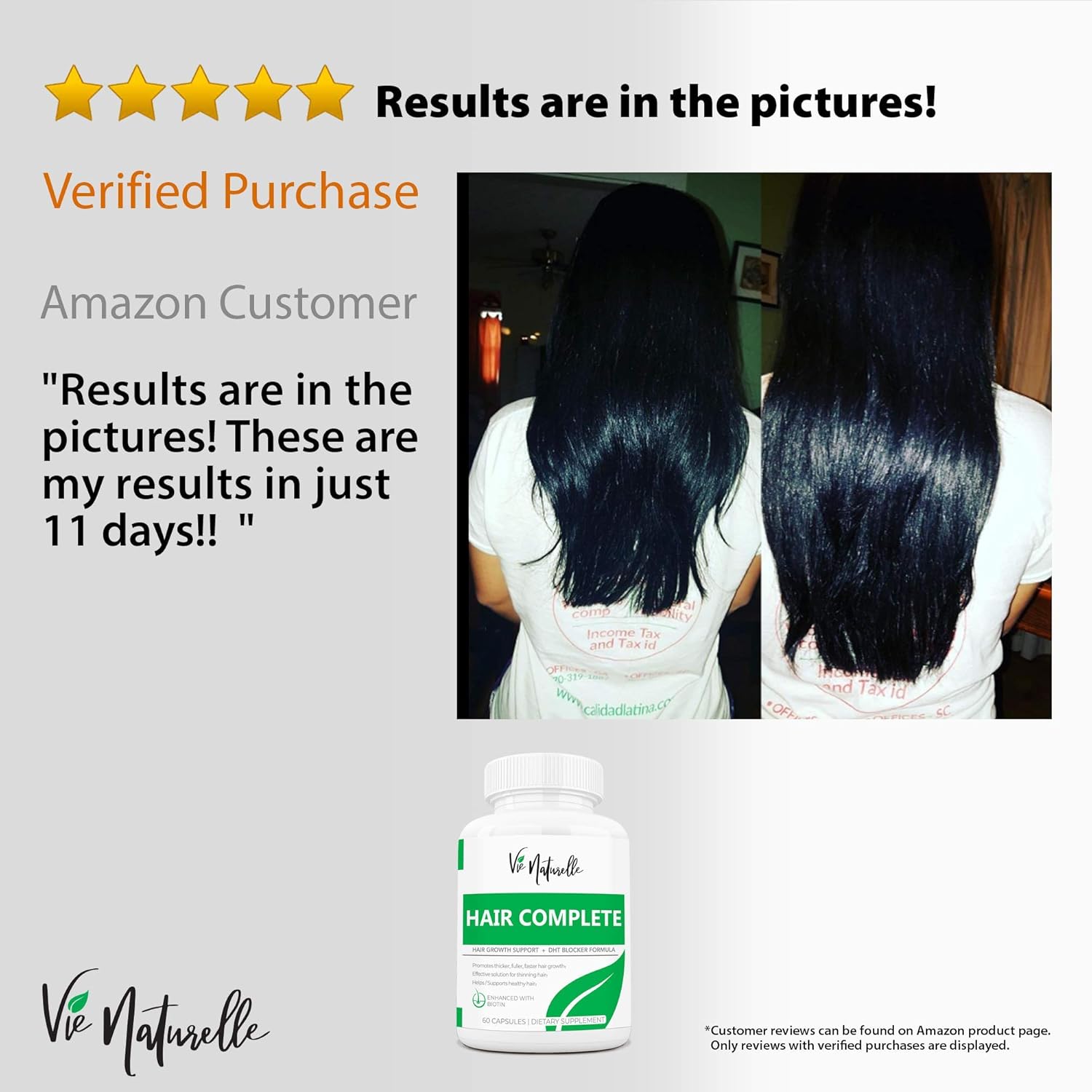 DHT Blocker Pills & Hair Supplement - Hair Growth Vitamins for Women & Men - Hair Loss Treatments for Women with Saw Palmetto - Hair Regrowth Treatment: Health & Personal Care