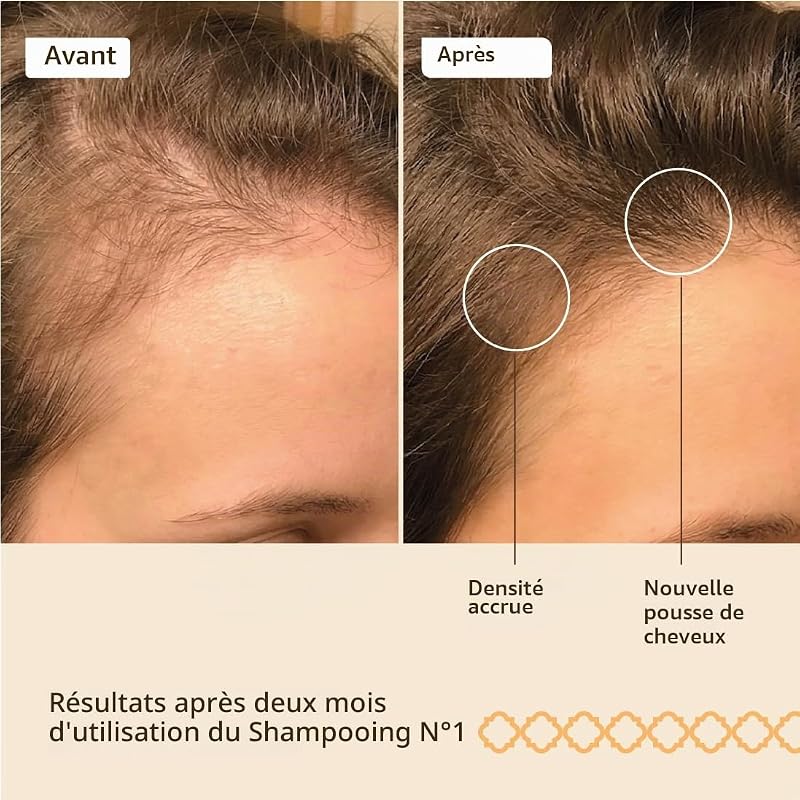 Nº1 Red Onion Shampoo. Freine la chute de cheveux 2 x 250 ml