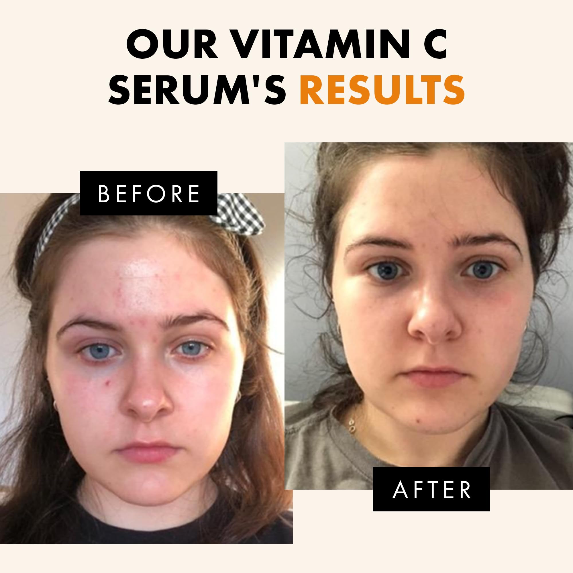 Eclat Skincare Vitamin C Face Serum - Skin Care for Dark Spots, Vitamin C Serum with Hyaluronic Acid, Ferulic Acid, & Vit E - Anti Aging and Skin Brightening, Pure Vit C Facial Care - 30 ml