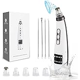 Blackhead Remover, EUASOO USB Rechargeable Pimple Extractor, Electric Pore Vacuum Blackhead Remover Tools for Women & Men, Blackhead Vacuum Kit with 10 * Filter Sponge & 5 * Rubber Ring & etc.