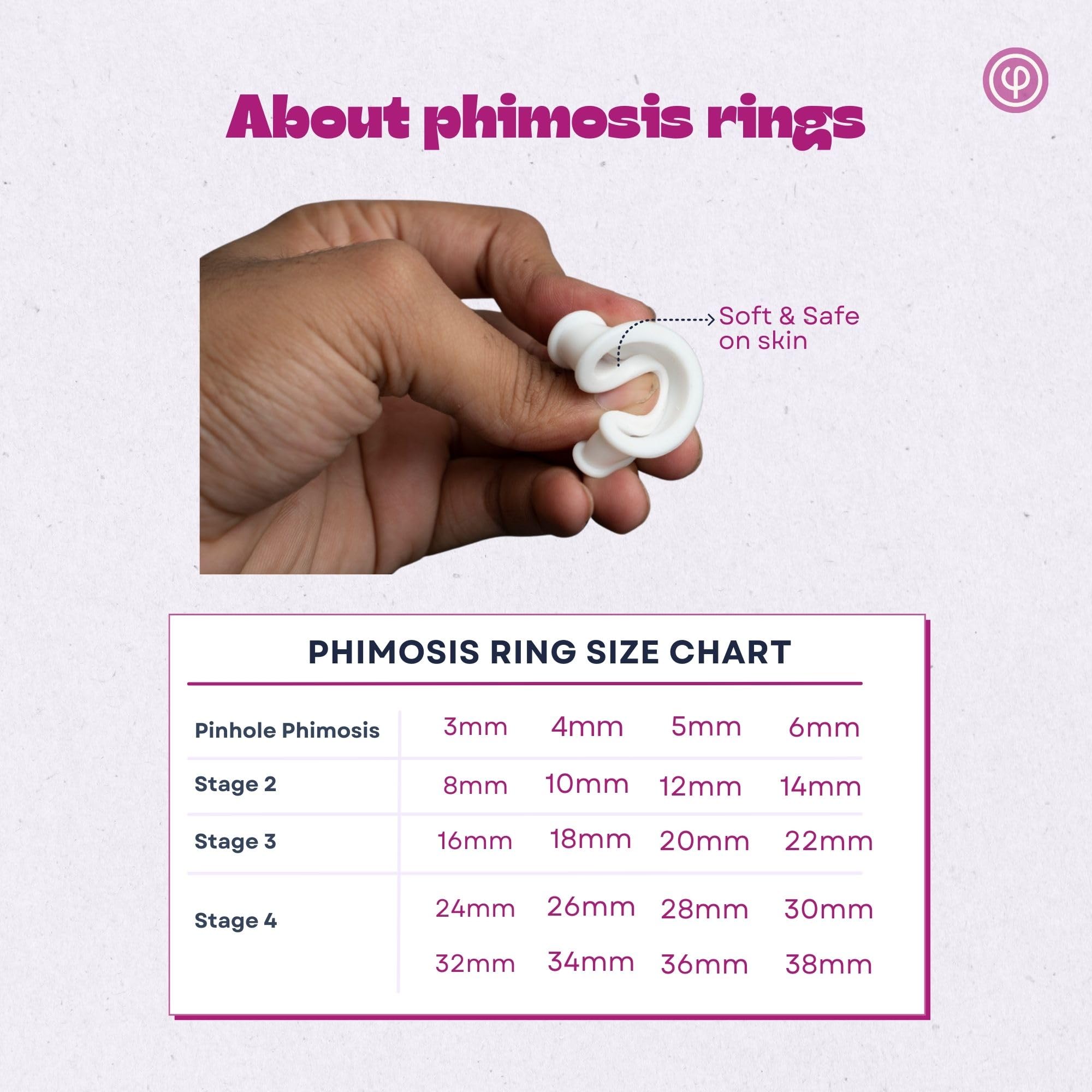 Phimosis Pro Kit with 20 x Phimosis Rings, 1 x Phimosis Cream, 1 x Phimosis oil, 1 x Track Sheet, 1 x 'How to use' booklet | Phimosis home kit | Proven results | Medical grade silicone