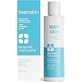 Acne Clarifying Face Toner for Teens by Natural Outcome Skin Care - Salicylic Acid Facial Astringent to Clear Acne & Purify Pores - Fragrance Free, Alcohol Free 6.7 oz