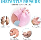 Xemz Pink Moisturizing Gloves Socks Set for Dry Hands Feet Skin Care Repair view 5