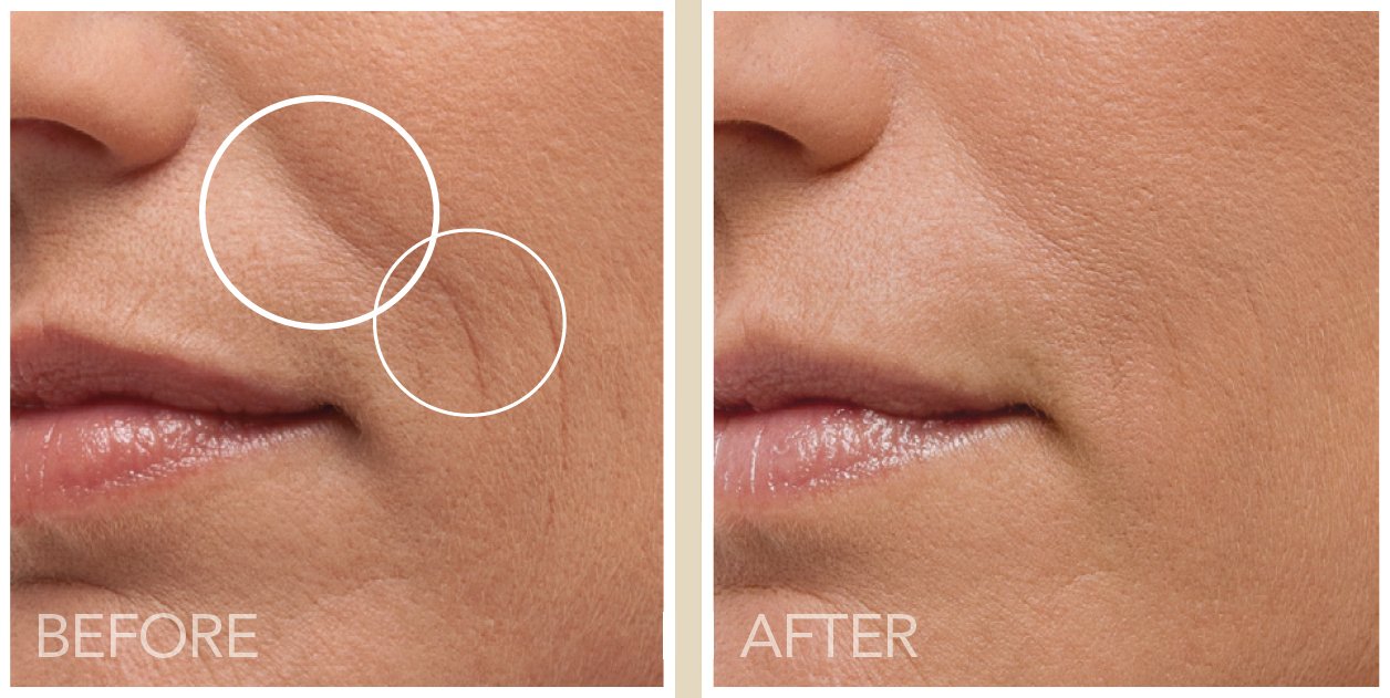 Intensively Hydrating Moisturizer Day Cream by Lirene - Collagen Booster Hydrating Complex - with Pearl Extract, Shea Butter and UV Protection for 50+ Women - 50 ml