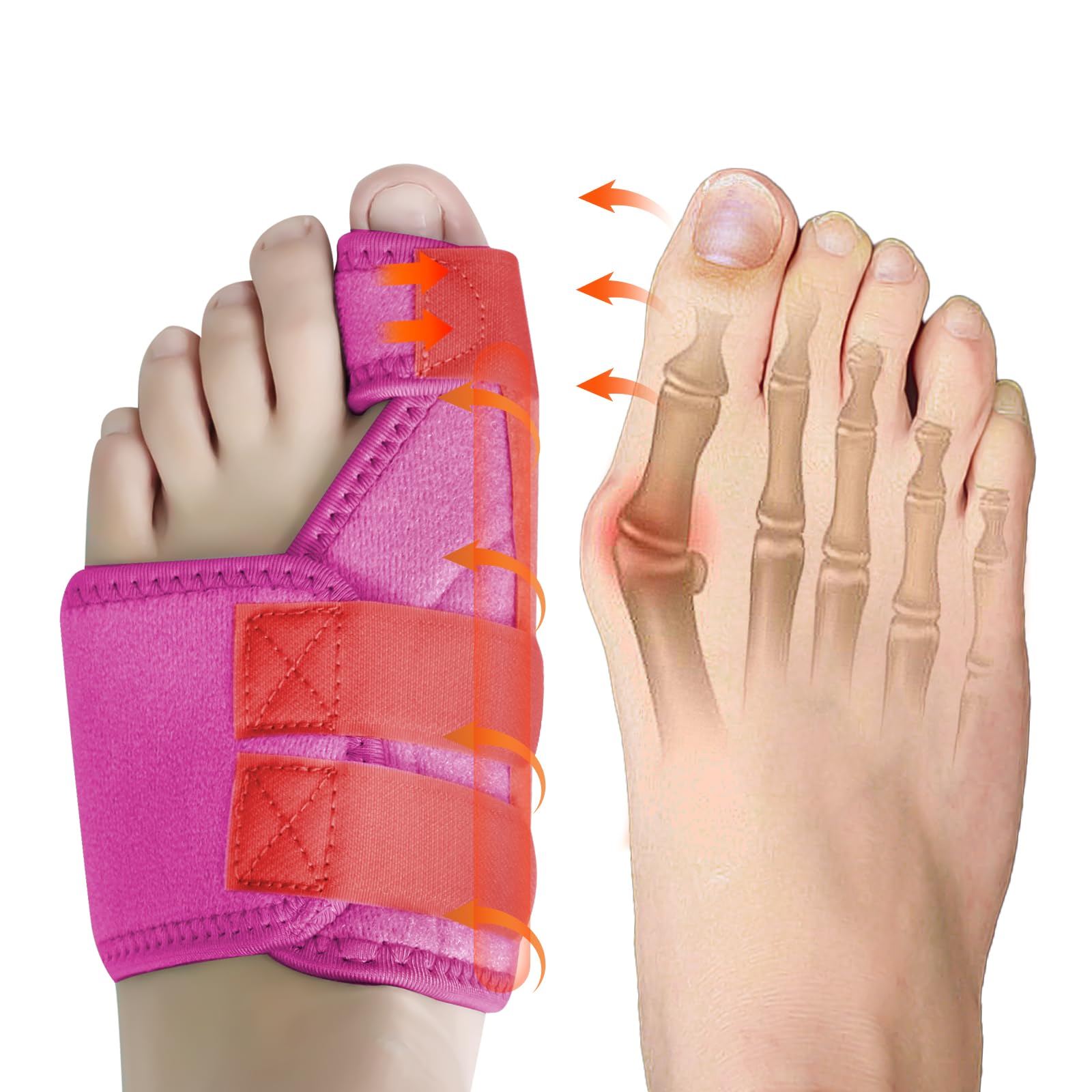 Ruilaibao Bunion Corrector Big Toe Straightener for Women and Men Bunion Splint for Big Toe Pain Relief Bunion Support for Day Night Foot Pain Relief (Rose red, left)