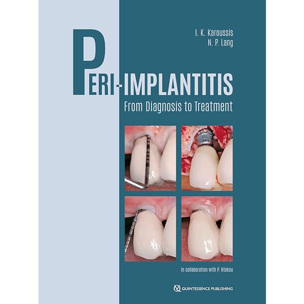 The Ortho-Perio Patient: Clinical Evidence & Therapeutic