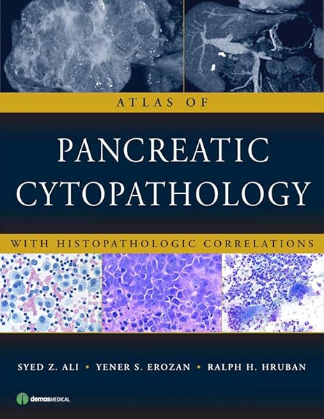 Atlas Of Pancreatic Cytopathology With Histopathologic Correlations Ali Md Syed Z Erozan Md Yener S Hruban Md Ralph H 8601415713190 Amazon Com Books