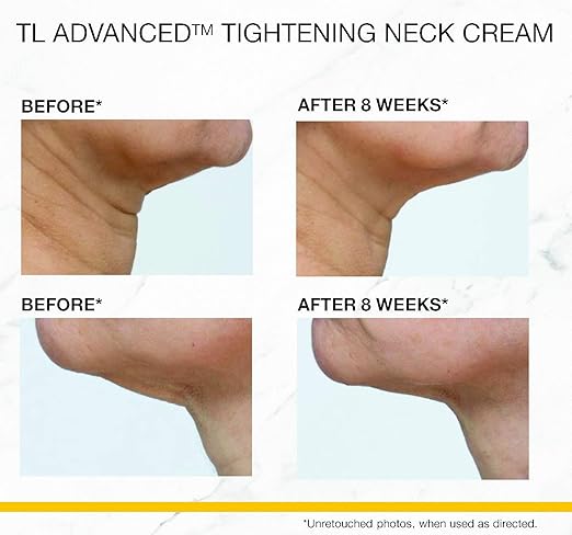 strivectin face and neck cream