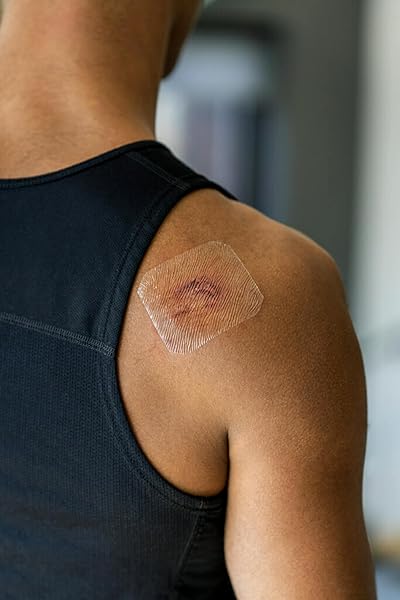 NEXCARE TEGADERM TRANSPARENT DRESSING, CLEAR FILM LETS YOU SEE WOUNDS HEAL, WATERPROOF DRESSING HOLDS FAST FOR 7 DAYS – 10 DRESSINGS