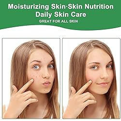 MMPANG USDA Certified 100% Pure Organic Castor Oil