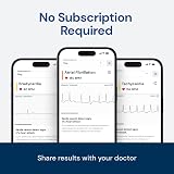 AliveCor KardiaMobile Personal EKG Device Single-Lead ECG FDA Cleared view 3