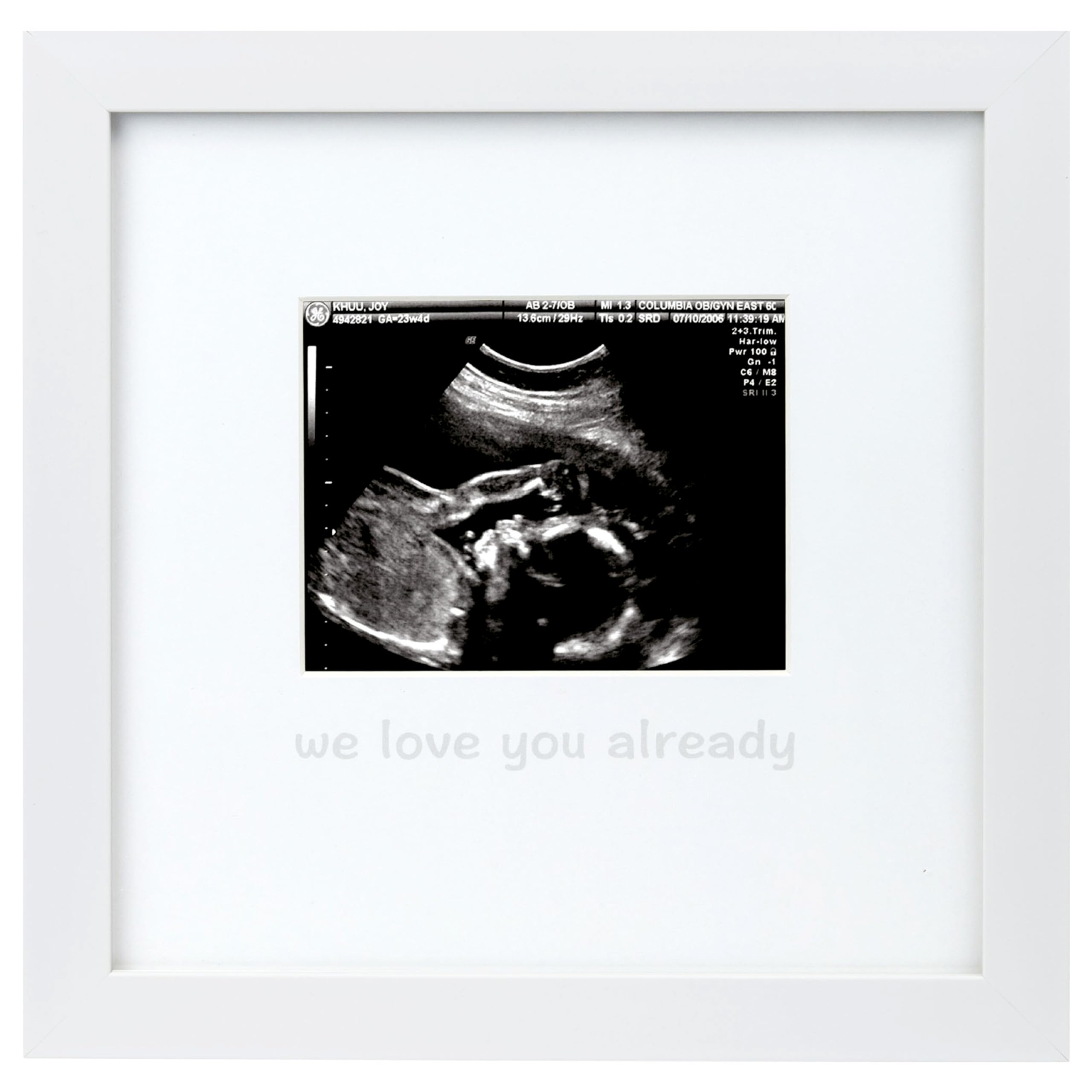 Photo 1 of tiny ideas We Love You Already Sonogram Sentiment Frame, Baby Announcement, Gender Neutral Ultrasound Keepsake, Ideal Pregnancy Gift, Baby Shower and Nursery Decor, 4”x5” Photo Insert, White