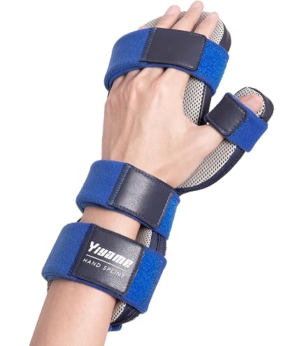 FEATOL Rest Hand Splint - Removable Metal Splint For Carpal Tunnel, Stroke Recovery, Arthritis