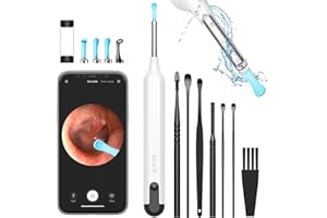 YUMIKA Ear Wax Removal Tool, Ear Cleaner with 1080P HD Camera, Ear Cleaner Kit with 7 PCS Ear Set, Wireless Otoscope with 6 Lights, Ear Wax Removal Kit for iPhone, iPad, Android Smart Phones（White）