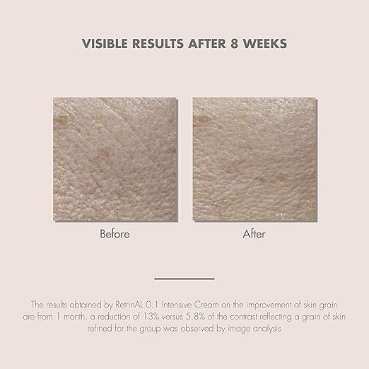 avene retrinal intensive cream