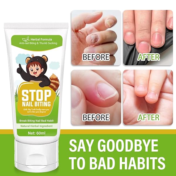 NAIL BITING TREATMENT FOR KIDS, NAIL BITING PREVENTION FOR KIDS & ADULTS, 100% NATURAL PLANTS