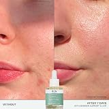 REN Evercalm Barrier Support Elixir 30ml Sensitive Skin Redness Hydration Oil view 3