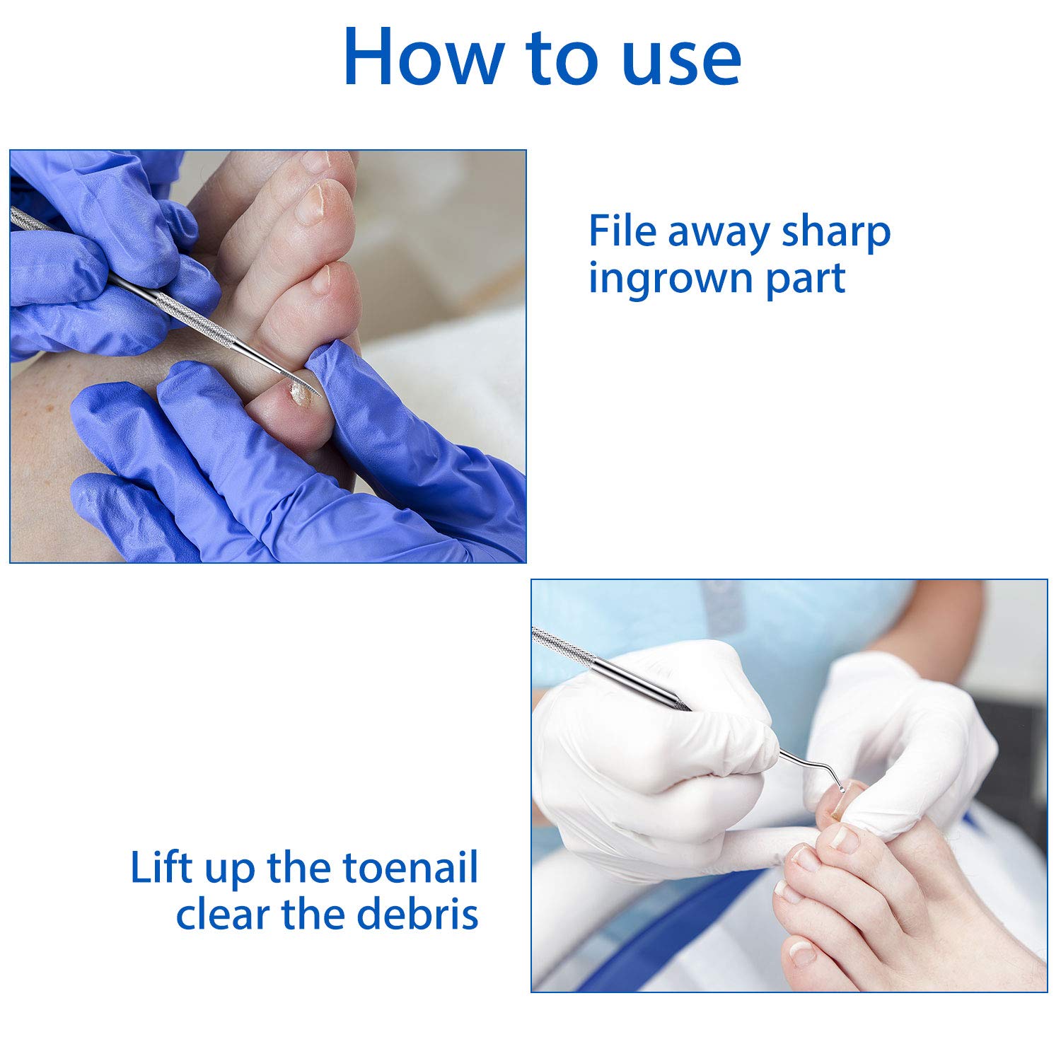 6 Pieces Ingrown Toenail File and Lifter Set Ingrown Toenail Tools Stainless Steel Double Sided Nail File Lifter Under Nail Cleaner Tools: Beauty