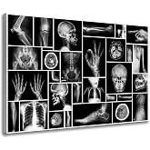 Black and White Human Skull Wall Art Canvas Painting X-Ray Picture Poster Prints Wall Picture For Hospital Orthopedic Surgeon Office Wall Decor Ready Hanging on 24x36inch (24