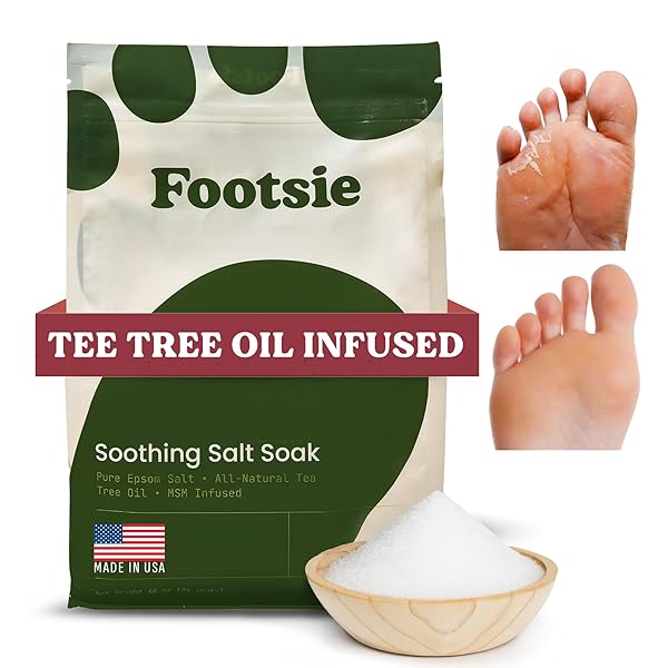 FOOTSIE SOOTHING TEA TREE OIL EPSOM SALT SOAK – FOR CALLUSES, ACHES & PAIN, ATHLETE’S FOOT – MADE IN USA – SOOTHES CRACKED HEELS, FLAKY SKIN – 100% ORGANIC, PEDICURE SPA SALT (ATHLETE’S FOOT & ODORS)