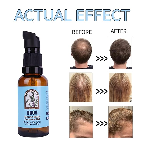 UBOV ROSEMARY OIL FOR HAIR, HAIR GROWTH OIL ORGANIC ROSEMARY ESSENTIAL OIL FOR HAIR – ORGANIC HAIR OIL FOR DRY SCALP TREATMENT AND ENHANCED VOLUME AND SHINE(1OZ,30ML)