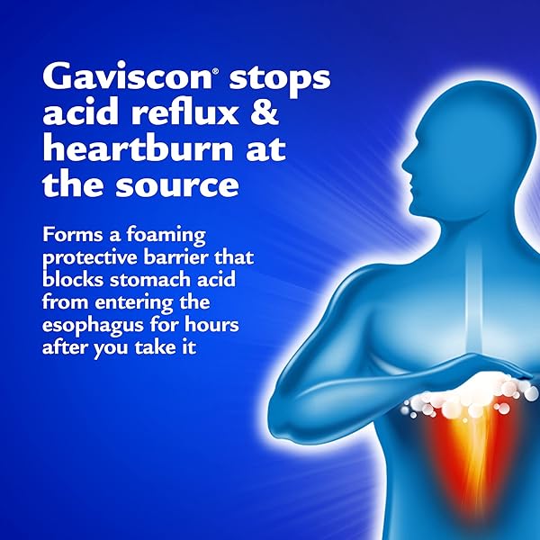 GAVISCON MAX BERRY TABLET, 50 COUNT