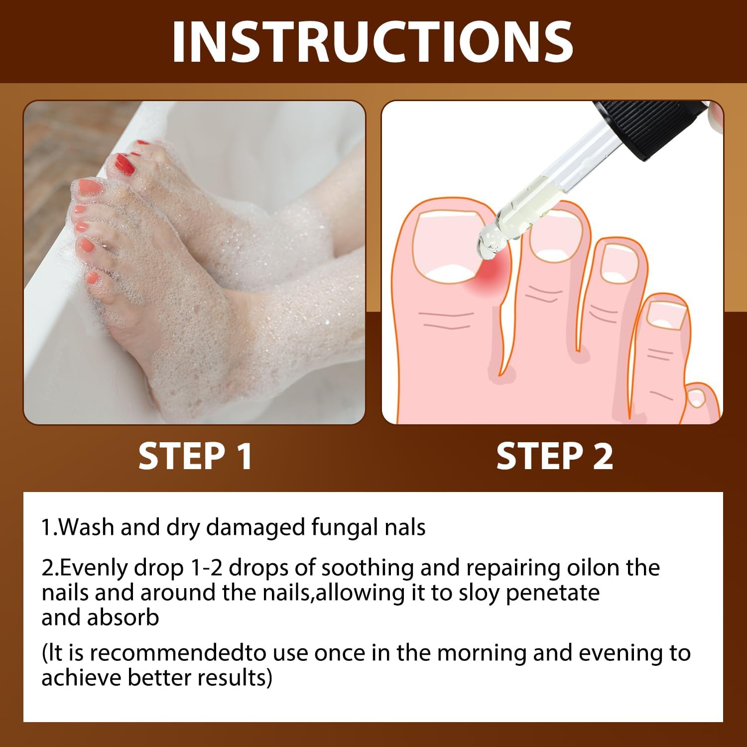 2PCS Paronychia Nursing Oil, German Toenailcare Anti Paronychia Relief Oil, Repair for Damaged Discolored Thick Nails - Image 6