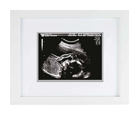 Pearhead P63015 Sonogram Errinerungs Rahmen, weiß