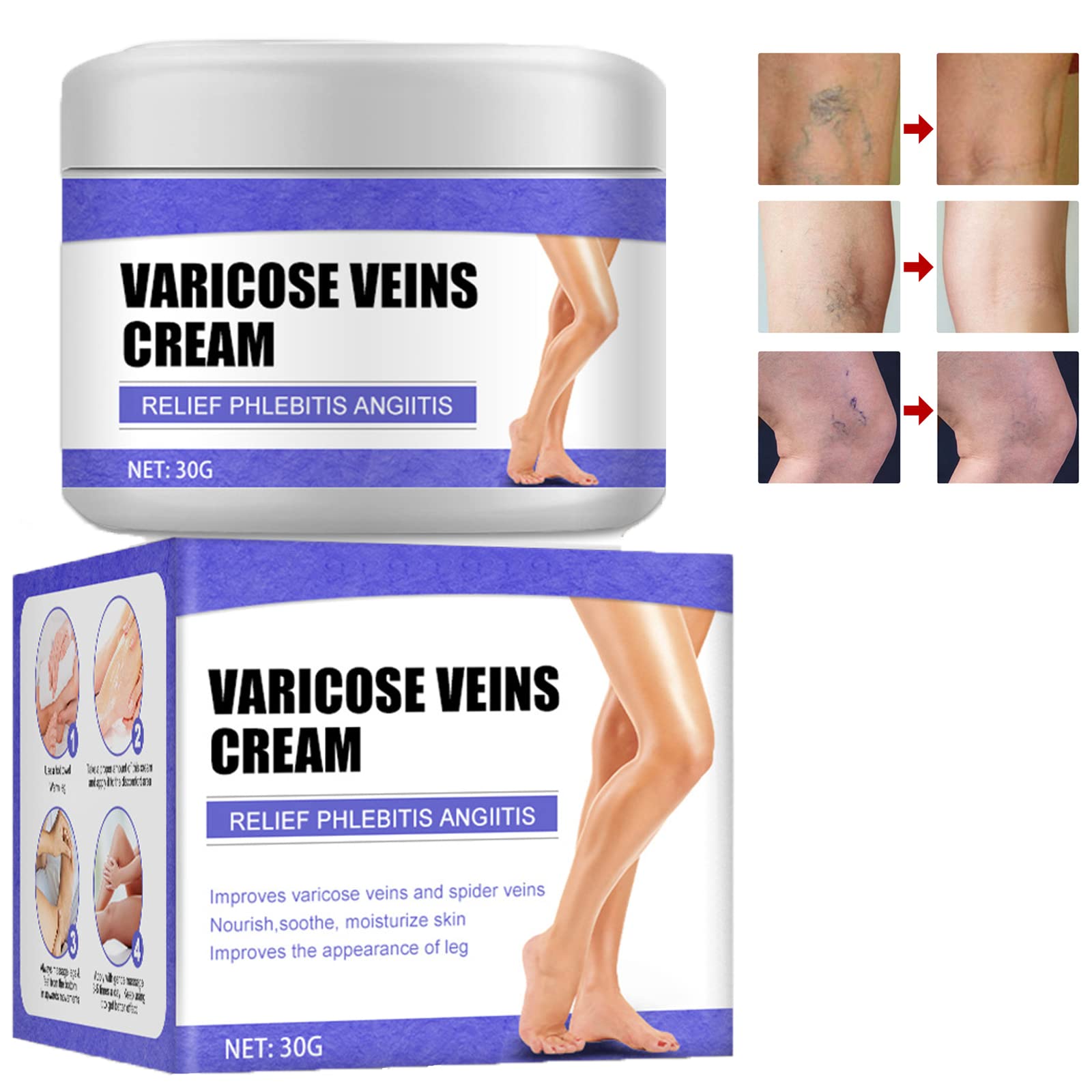 Varicose Veins Cream, Varicose Veins Cream, Cream for Spider Veins, Varicose Veins and Spider Veins Removal, Leg Care Cream, Gentle Leg Care, Improve Blood Circulation