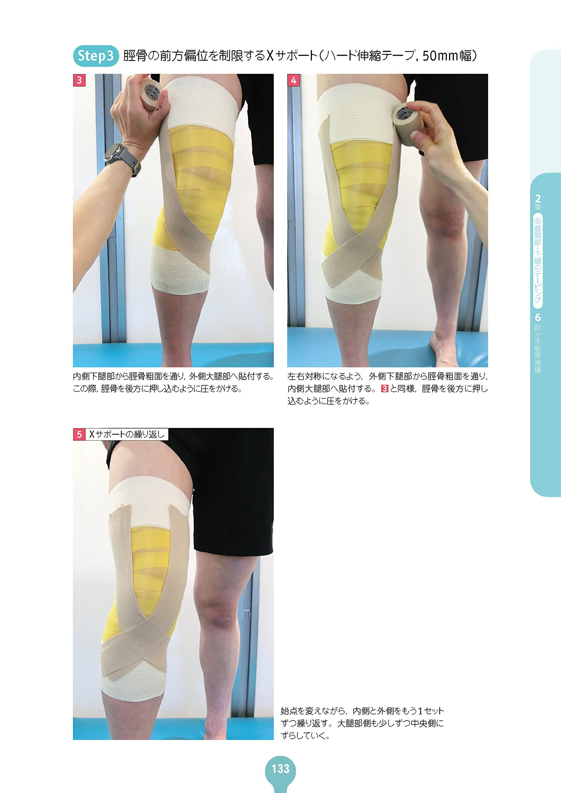 フルカラーでやさしくわかる テーピングの基本 電子版付 大内 洋 亀田メディカルセンタースポーツ医学科 主任部長 編著 本 通販 Amazon