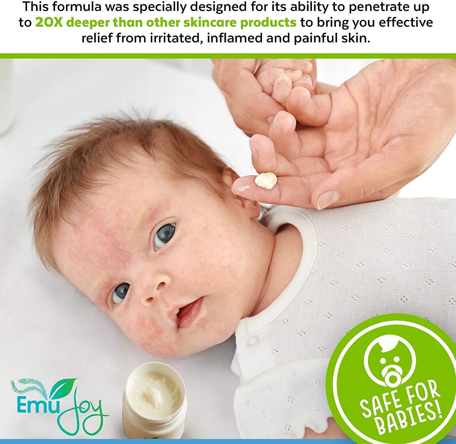 Emu Joy Soothe My Rash Kit for Eczema Psoriasis LIchen Sclerosus Rosacea Dermatitis - Natural Organic Relief for Irritated Skin: Health & Personal Care