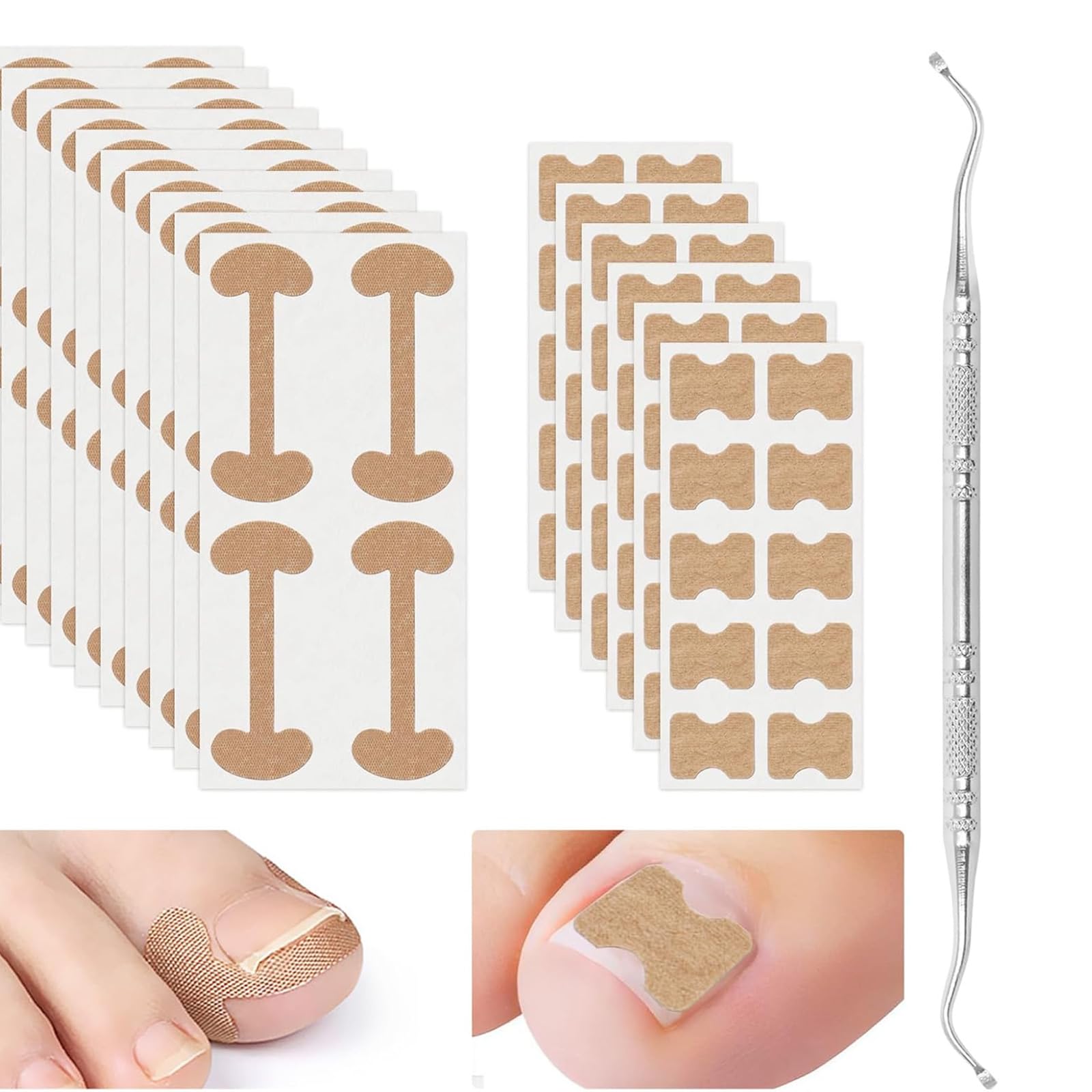 CVNRCLP 17 PCS Ingrown Toenail Treatment Kit - Includes 2 Types of Patches and Professional Correction Tool for Effective Toenail Care and Protection