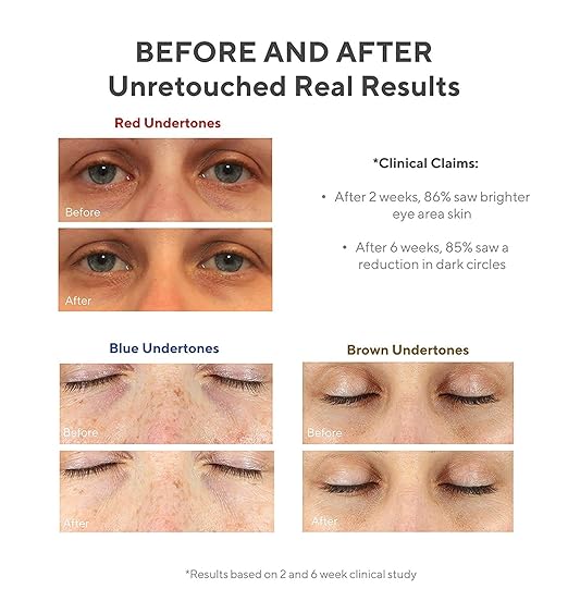 murad dark circle corrector