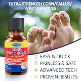 MYMULIKE Liquid for Corn Removers Extra Strength Foot Pain Relief 15ML view 2