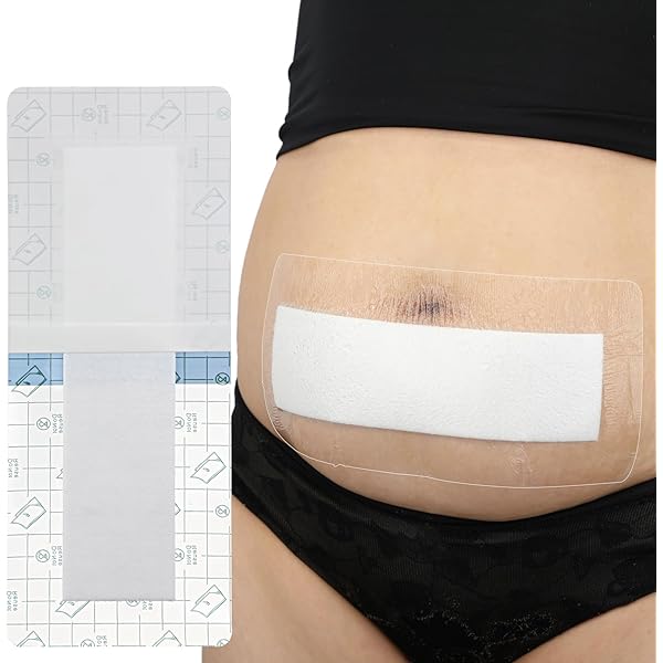 10 Pack Waterproof C-Section Dressings - 4x8 Inch Post Surgery Bandages For Tummy Tuck