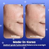 Avarelle Pimple Patches 24 Overnight Vegan Cruelty Free Thick Hydrocolloid Acne view 2