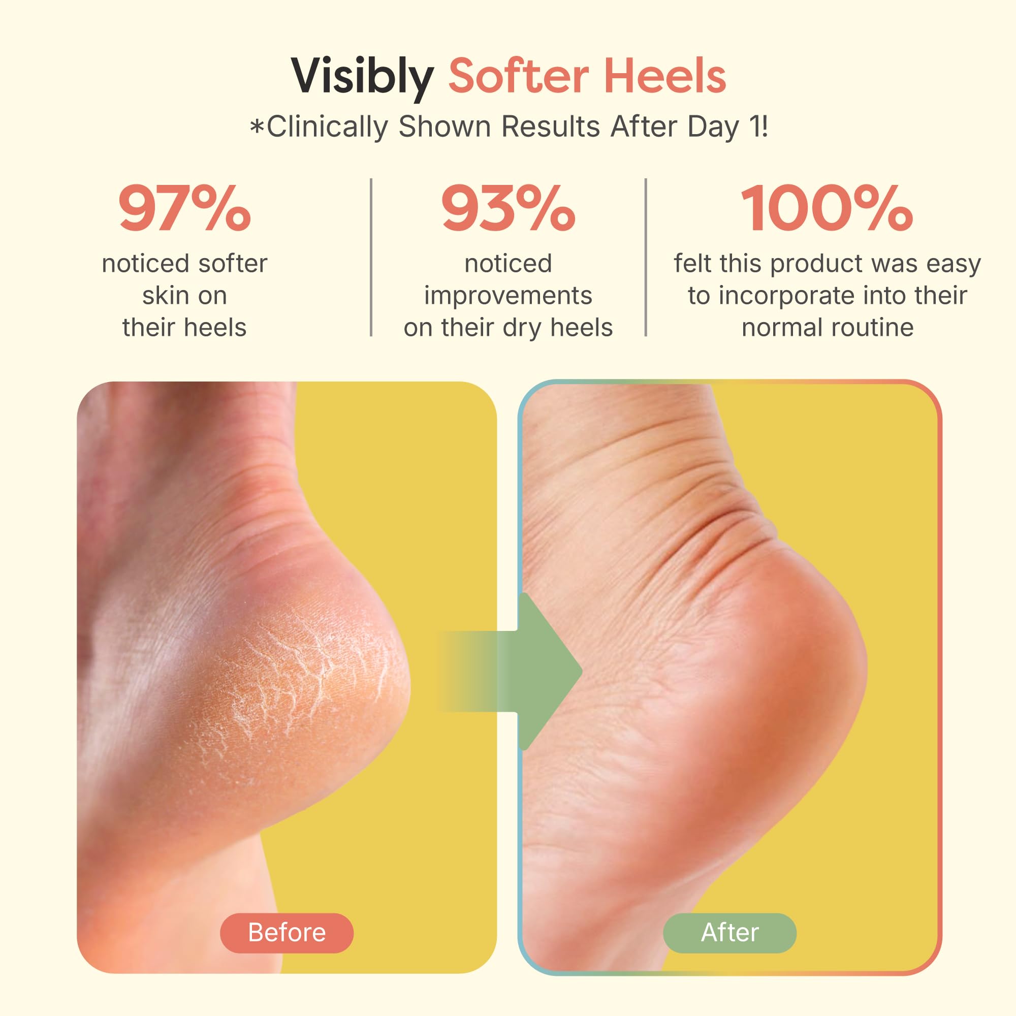 ZenToes Moisturizing Socks for Cracked Heel Treatment - Vitamin E, Olive Oil and Jojoba Oil Infused to Soften and Hydrate - Heel Socks for Dry Cracked Feet Women (Fuzzy Lilac Purple, Regular)