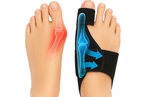 BENOO Bunion Corrector for Women & Men (2 Pack) Hammer Toe Straightener, Bunion Relief, Big Toe Separator, Adjustable Day & Night Support, Comfortable, One Size Fits All