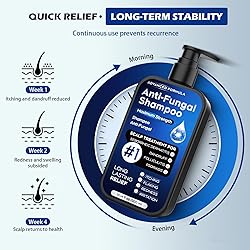 Antifungal Shampoo for Seborrheic