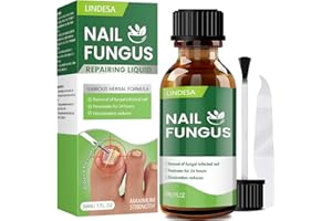 Calpol Toenail Fungus Treatment Extra Strength,Toenail Fungus Treatment,Nail Fungus Treatment Extra Strength for Athletes Foot, Thick, Broken, Discolored & Damaged Nail-30Ml