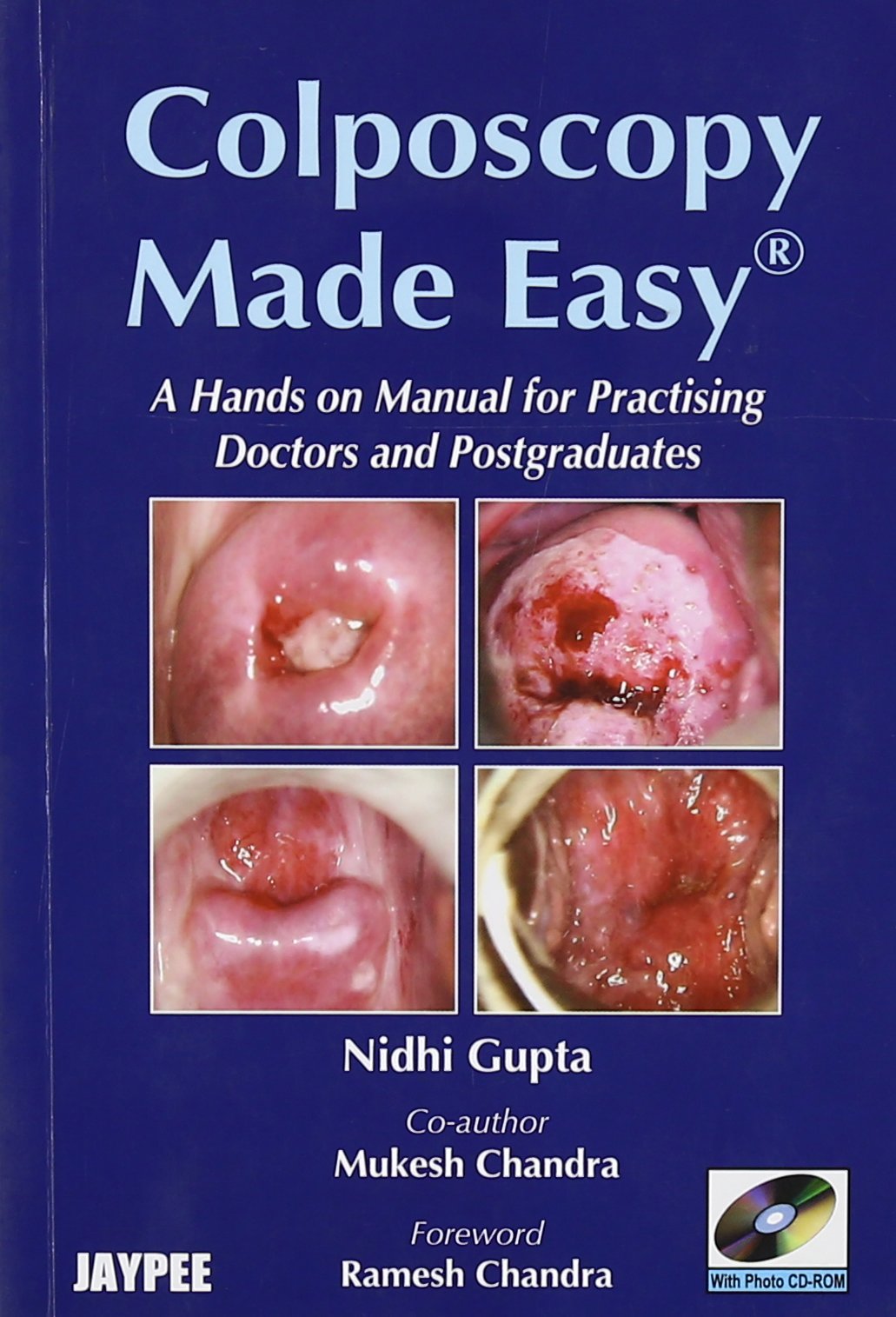 Colposcopy Made Easy: Gupta, Nidhi: 9788184484663: Amazon.com: Books