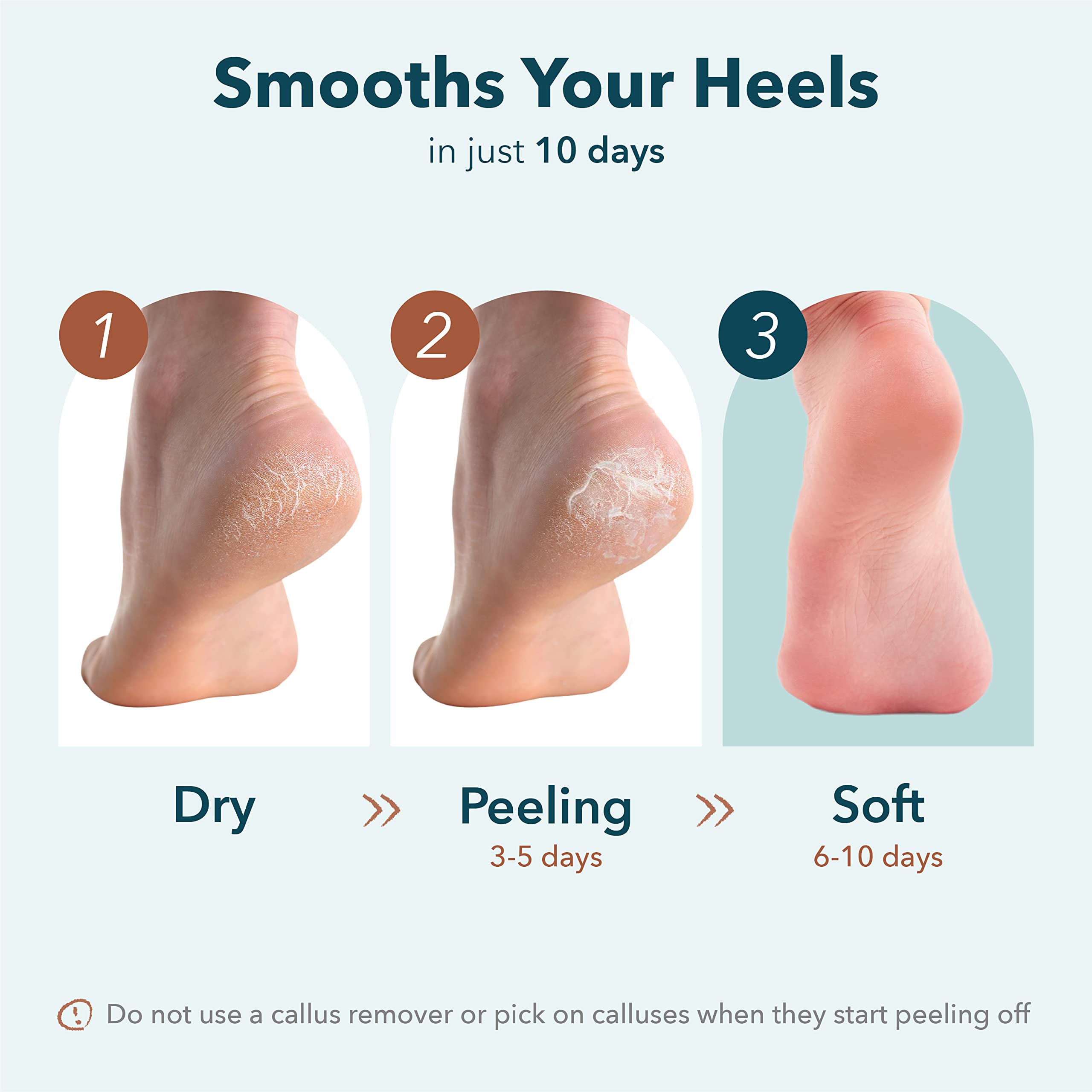 Purederm Exfoliating Heel Mask (1 Pair) – Heel Peeling Masks Gently Remove calluses from Your Heel